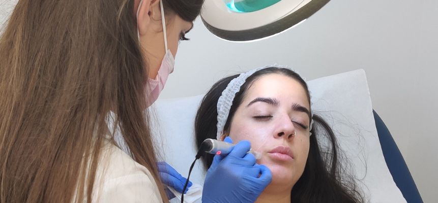tratamientos cara tratamiento para prevenir granos en la cara